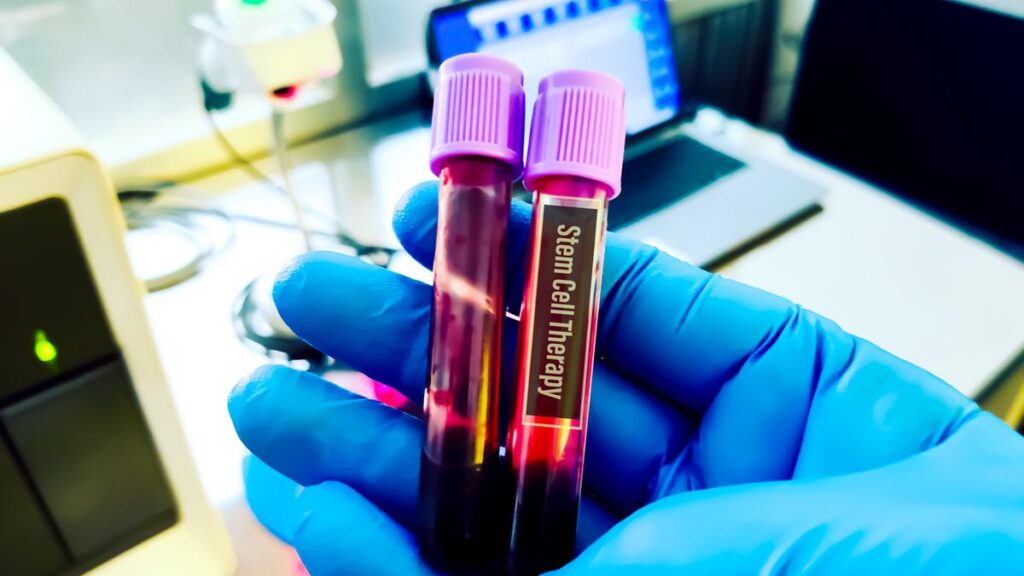 University of Hyderabad incubated startup announces successful animal trials of stem cell therapy for liver failure